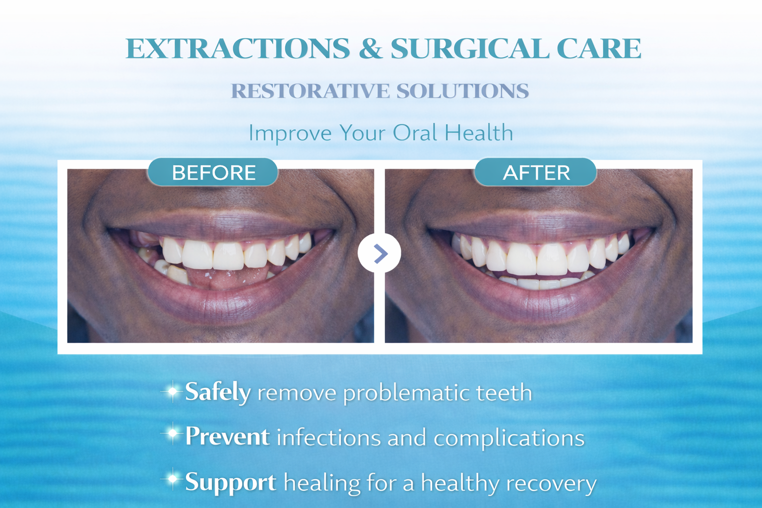 Extractions and Surgical Care