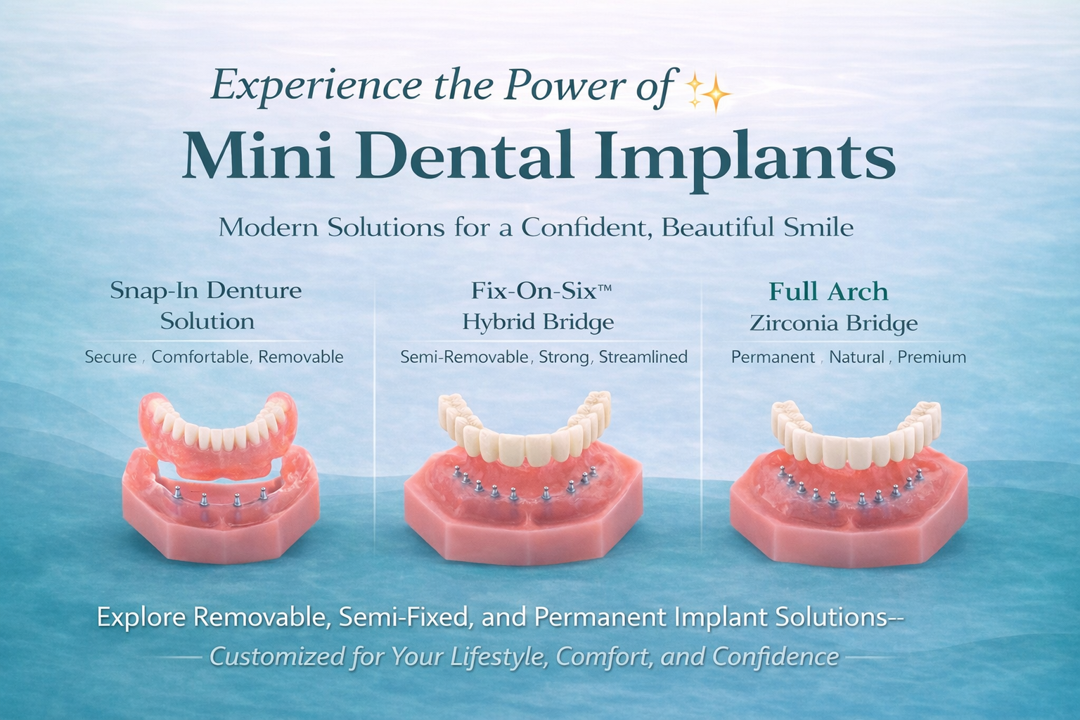 Dental Implants